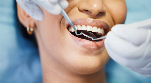 Best Cosmetic Emergency Dentistry in Salem, UT